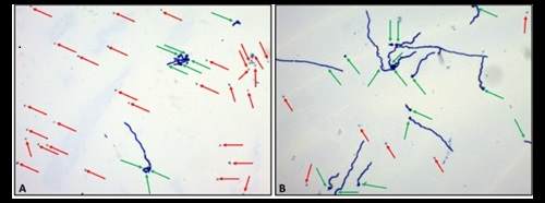 Resultados obtenidos mediante el método de germinación de conidios para Trichoderma asperellum después de 15 horas a 25 °C en agar patata-dextrosa. 4. Nuevo método PrecisionBio™ de Croda