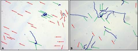 Résultats obtenus à l'aide de la méthode de germination des conidies pour Trichoderma asperellum après 15 heures à 25 °C dans un milieu gélosé à base de pomme de terre et de dextrose.