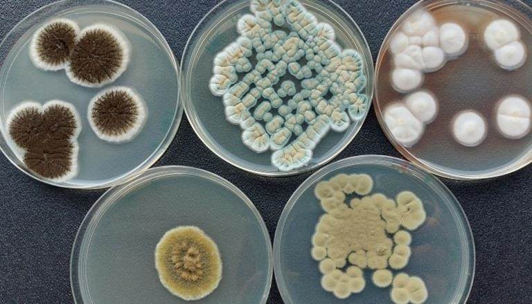Microbes